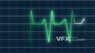 背景视频素材心跳监测仪器显示心电图波动