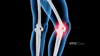 C4D制作人体膝盖疾病透视骨骼红标模型